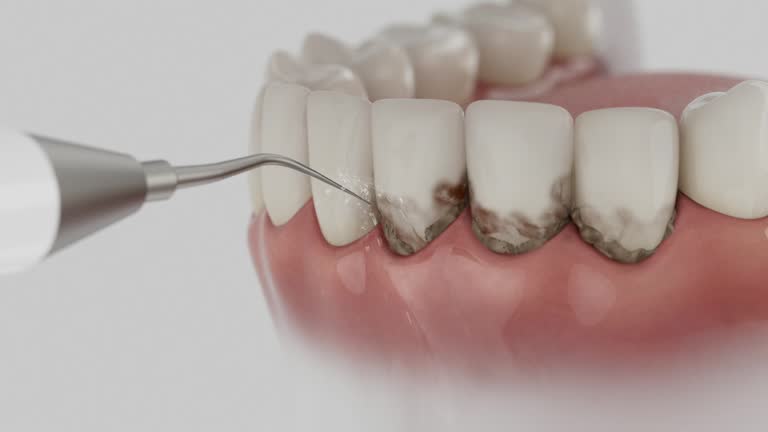 Reliable Teeth Cleaning And Checkup contractor in Mississippi, MS by Dentist Open Now